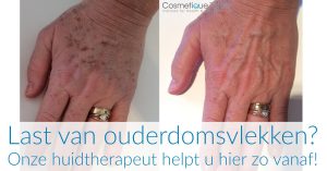 Huidtherapie-Laserbehandeling Eelde-Paterswolde Haren en Groningen