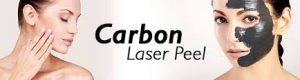 Carbon Laser Peeling in Eelde Paterswolde Groningen en Haren, Assen en Vries