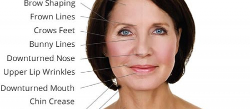 botox botox Studio 13 Eelde Paterswolde Groningen en Haren